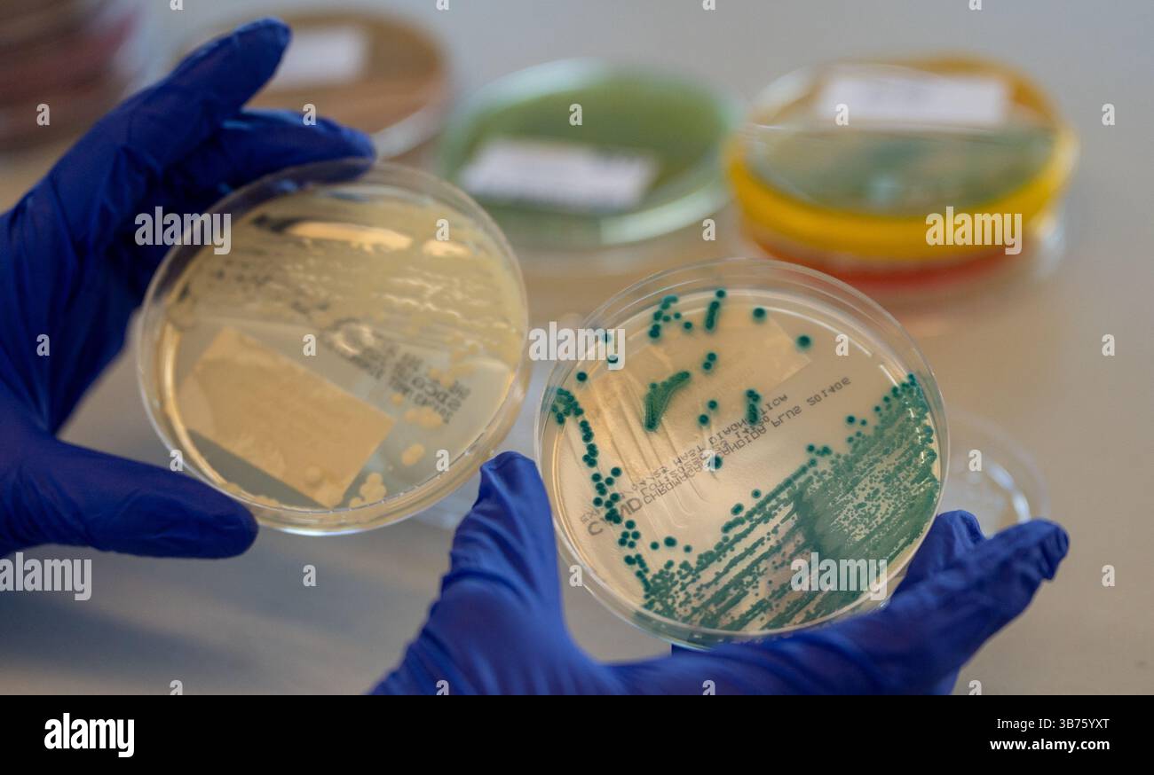 Monaco, Germania. 29 aprile 2025. Un dipendente dell'Ufficio statale bavarese per la salute e la sicurezza alimentare (LGL) detiene due capsule di Petri con campioni batterici in un laboratorio dell'LGL a Oberschleissheim. Entrambi i campioni sono "Phoenix strain". candida albicans'. Crediti: Leonie Asendorpf/dpa/Alamy Live News Foto Stock Monaco, Germania. 29 aprile 2025. Un dipendente dell'Ufficio statale bavarese per la salute e la sicurezza alimentare (LGL) detiene due capsule di Petri con campioni batterici in un laboratorio dell'LGL a Oberschleissheim. Entrambi i campioni sono "Phoenix strain". candida albicans'. Crediti: Leonie Asendorpf/dpa/Alamy Live News Foto Stock