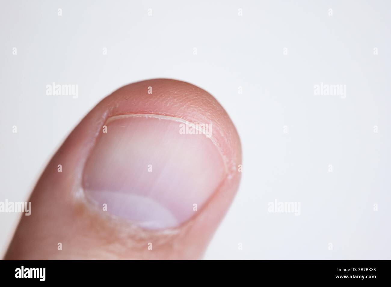 Dito del pollice o del dito del maschio caucasico. Primo piano macro, isolato sul bianco. Foto Stock
