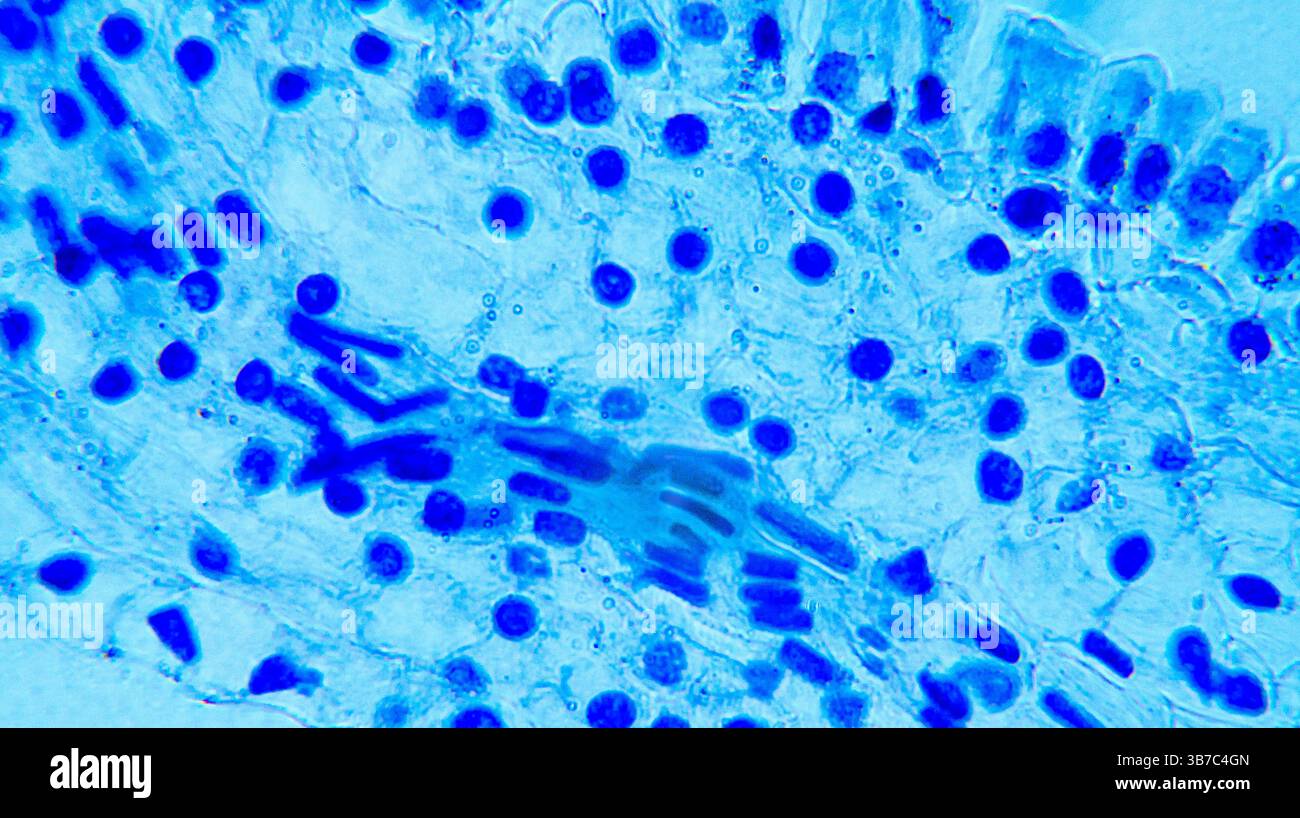 Lillium 0Vare sotto microscopio ottico Foto Stock