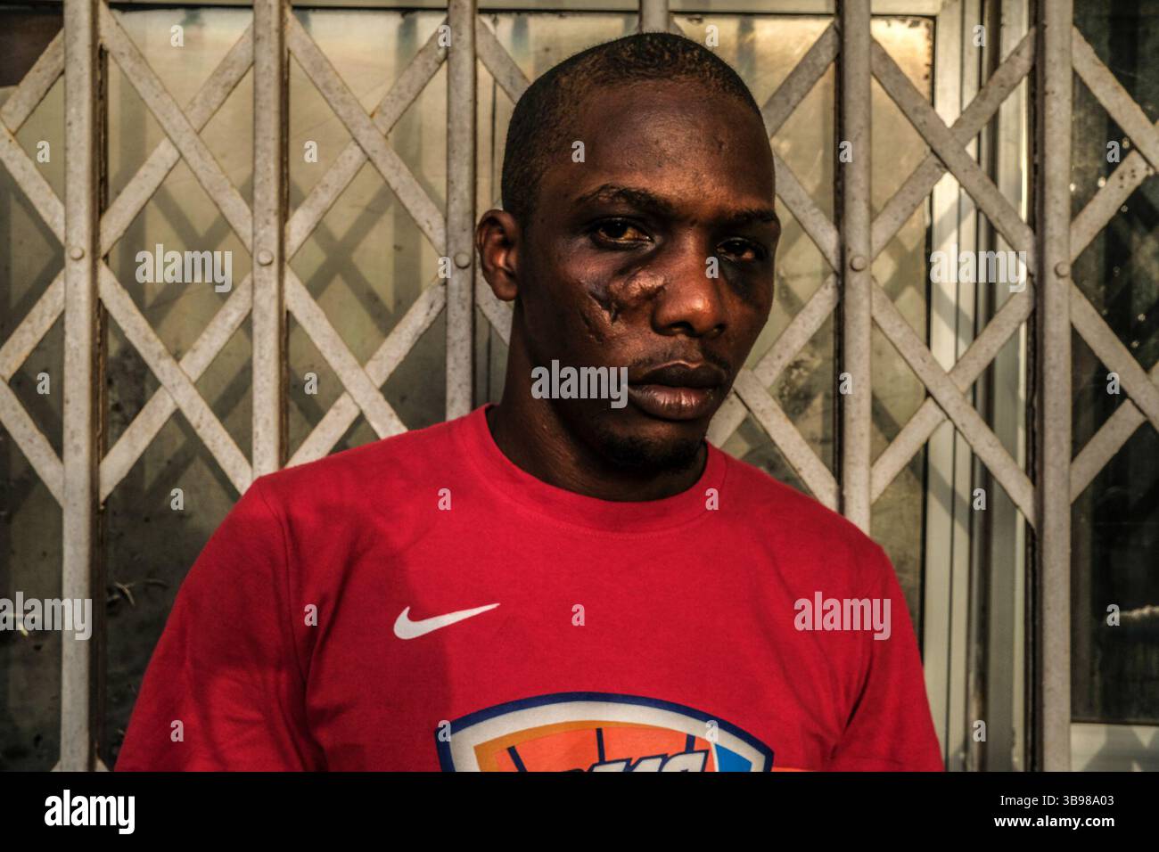 1° marzo 2020, Conakry, Conakry, Guinea: Lamran Bah, vicepresidente dell'associazione giovanile "asse", ha dichiarato di essere stato arrestato nella sua casa di Kipe, poi incarcerato e torturato dalle forze dell'ordine a Conakry... da metà ottobre, la capitale della Guinea vive al ritmo delle scene di guerriglia urbana tra giovani dimostranti del fronte Nazionale per la difesa della Costituzione e della polizia. Protestano contro la volontà del presidente Alpha Conde di candidarsi per un terzo mandato cambiando la Costituzione. Almeno trenta persone sono morte negli scontri dalla fine del 2019 (Credit Image: Foto Stock