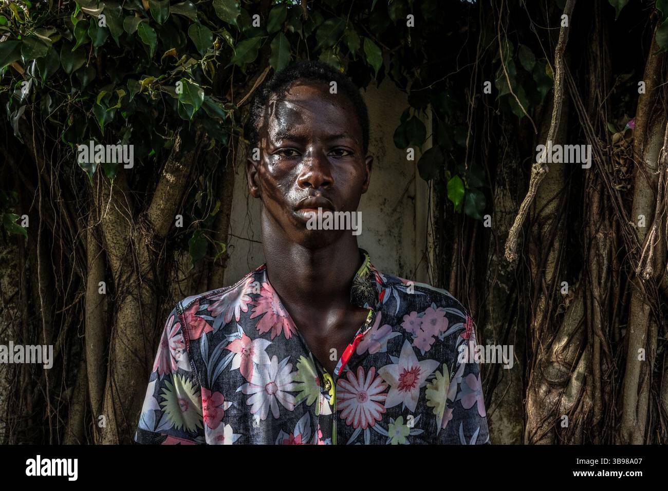 1 marzo 2020, Conakry, Conakry, Guinea: Il giovane ha cercato di sfuggire alle risse nel suo quartiere, ma è stato colpito al collo da una tanica di gas lacrimogeni... da metà ottobre, la capitale della Guinea vive al ritmo delle scene di guerriglia urbana tra giovani dimostranti del fronte Nazionale per la difesa della Costituzione e la polizia. Protestano contro la volontà del presidente Alpha Conde di candidarsi per un terzo mandato cambiando la Costituzione. Almeno trenta persone sono morte negli scontri dalla fine del 2019 (Credit Image: © Sadak Souici/ZUMA Press Wire) Foto Stock