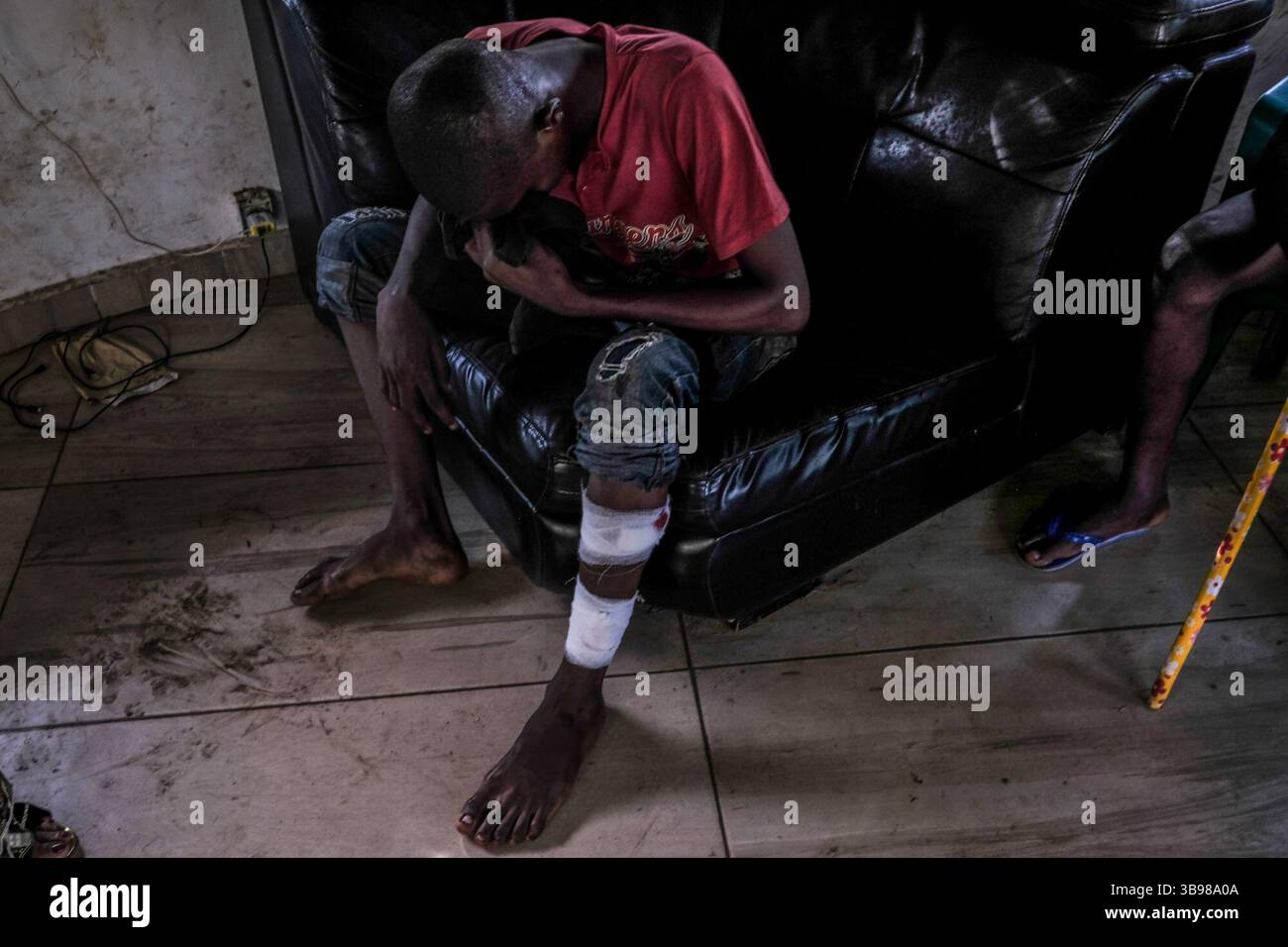 1 marzo 2020, Conakry, Conakry, Guinea: Alpha Amadou Bah sta cercando di trovare una posizione per alleviare la sua gamba, ferita da due colpi di proiettili della polizia, presso la sede di un partito di opposizione nella capitale... da metà ottobre, la capitale della Guinea vive al ritmo delle scene di guerriglia urbana tra giovani dimostranti del fronte Nazionale per la difesa della Costituzione e la polizia. Protestano contro la volontà del presidente Alpha Conde di candidarsi per un terzo mandato cambiando la Costituzione. Almeno trenta persone sono morte negli scontri dalla fine del 2019 (Credit i Foto Stock