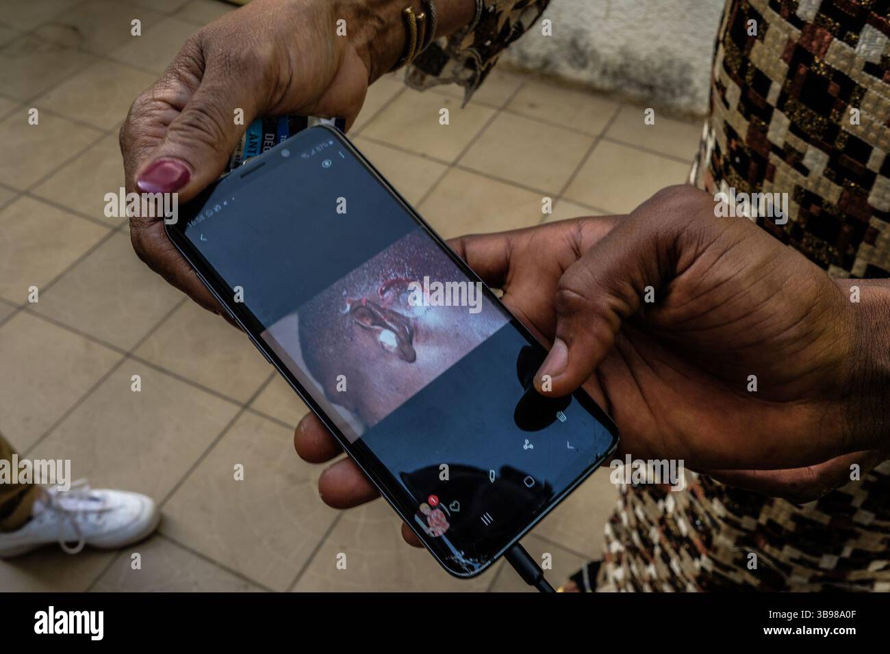 1 marzo 2020, Conakry, Conakry, Guinea: Un alto funzionario dell'opposizione mostra sul suo telefono la foto dell'infortunio di Alpha Oumar Keita scattata dopo le manifestazioni a Conakry, 29 febbraio 2020... da metà ottobre, la capitale della Guinea vive al ritmo delle scene di guerriglia urbana tra giovani dimostranti del fronte Nazionale per la difesa della Costituzione e la polizia. Protestano contro la volontà del presidente Alpha Conde di candidarsi per un terzo mandato cambiando la Costituzione. Almeno trenta persone sono morte negli scontri dalla fine del 2019 (Credit Image: © Sadak so Foto Stock