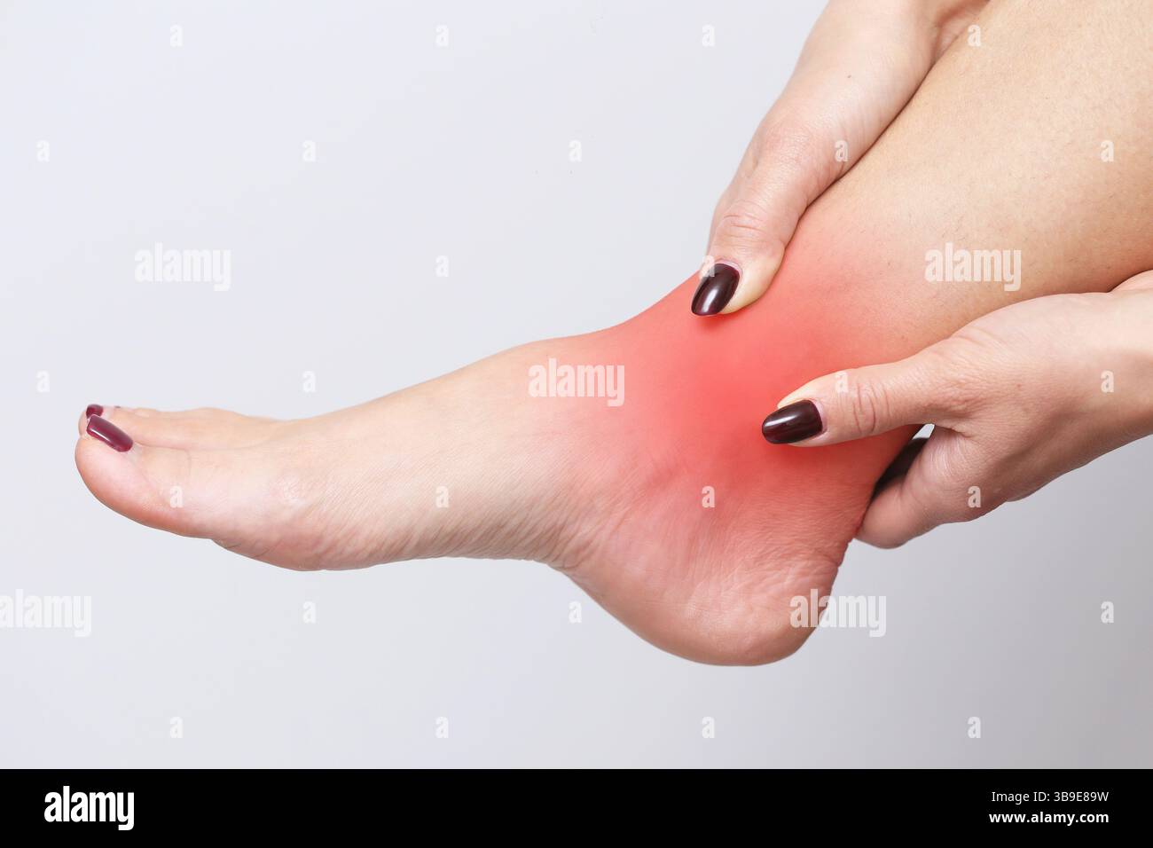 Concetto di infiammazione del dolore alla caviglia. Donna che tiene il piede gonfio rosso. Sintomo di lesione medica. Problema di disagio articolare. Problema sanitario. Primo piano del dolore ai piedi Foto Stock