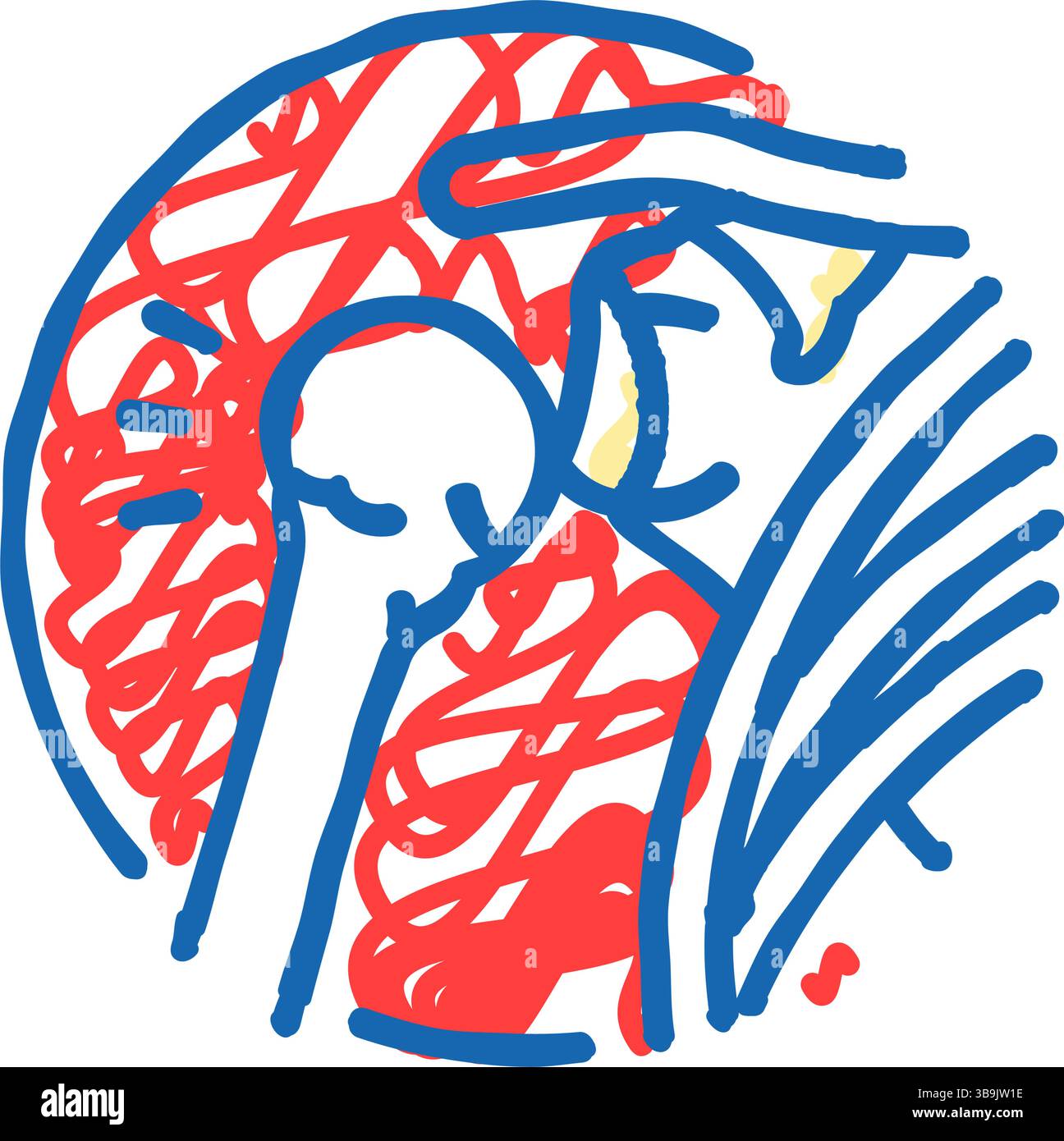 illustrazione a forma di doodle con l'icona di lesione da frattura di lussazione articolare Illustrazione Vettoriale