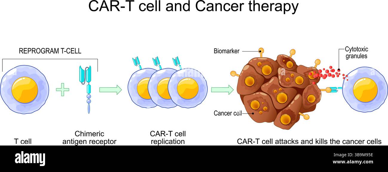 Terapia con cellule T DELL'AUTO. Processo di immunoterapia contro il cancro. Leucociti che uccidono il tumore. Geneticamente modificato. Medicina personalizzata. Illustrazione vettoriale Illustrazione Vettoriale