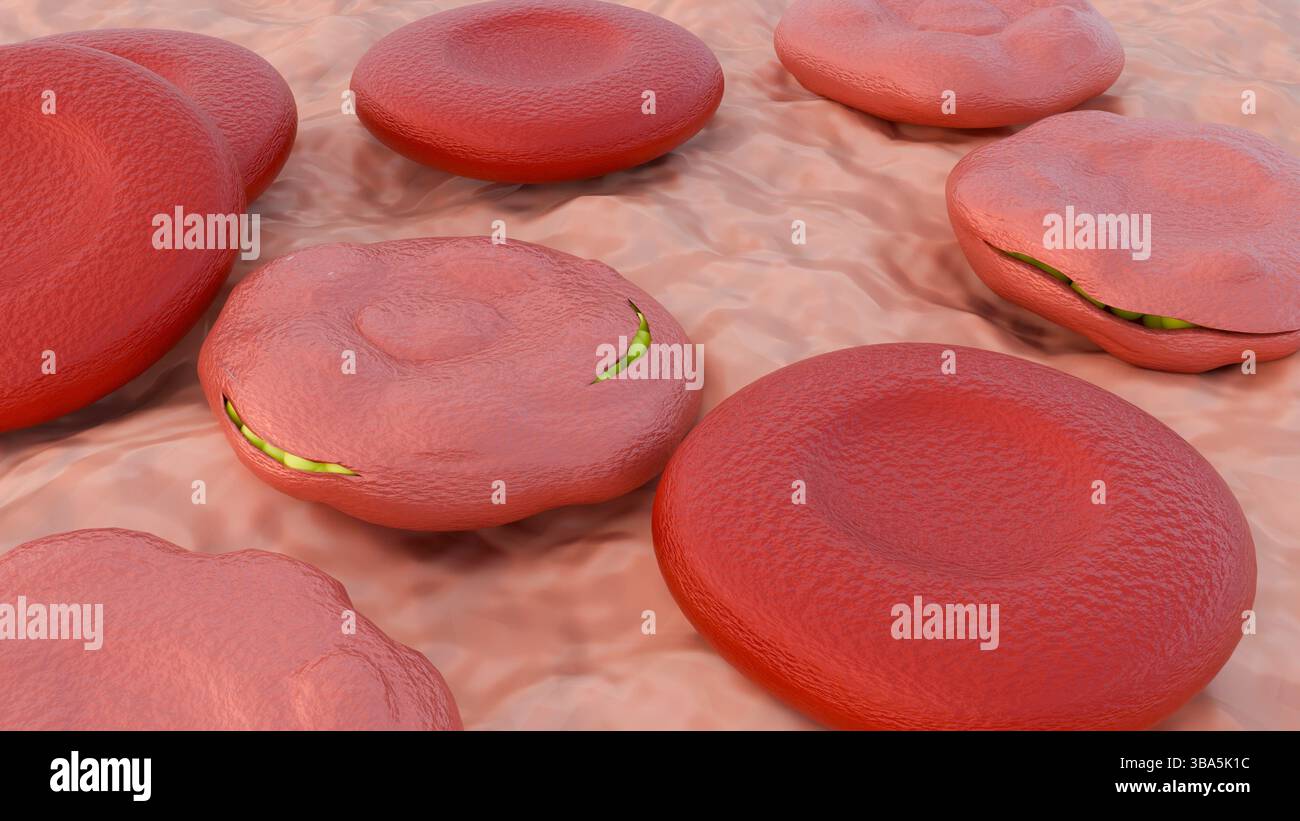 Una rappresentazione 3d dei globuli rossi rivela un'infestazione interna di numerosi parassiti nel suo stadio merozoite o trofozoite. Foto Stock