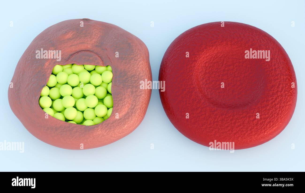 Una rappresentazione 3d dei globuli rossi rivela un'infestazione interna di numerosi parassiti nel suo stadio merozoite o trofozoite. Foto Stock