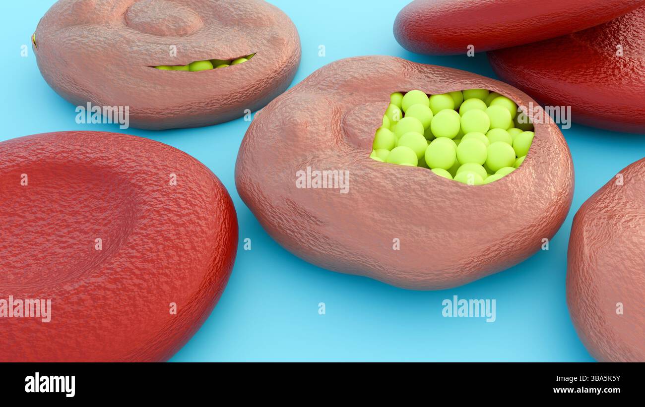 Una rappresentazione 3d dei globuli rossi rivela un'infestazione interna di numerosi parassiti nel suo stadio merozoite o trofozoite. Foto Stock