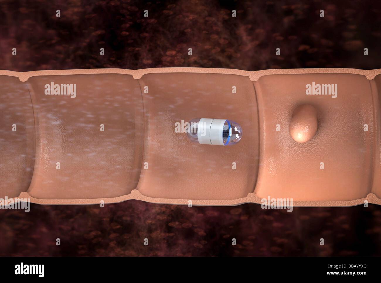 rendering 3d dell'endoscopia della capsula in filmati 4k con taglio intestino Foto Stock