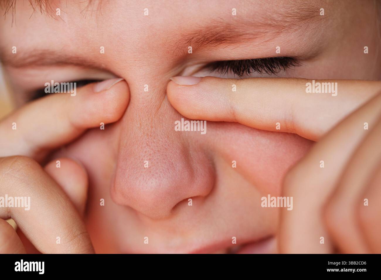 Ragazzo allergico che gratta gli occhi da vicino Foto Stock