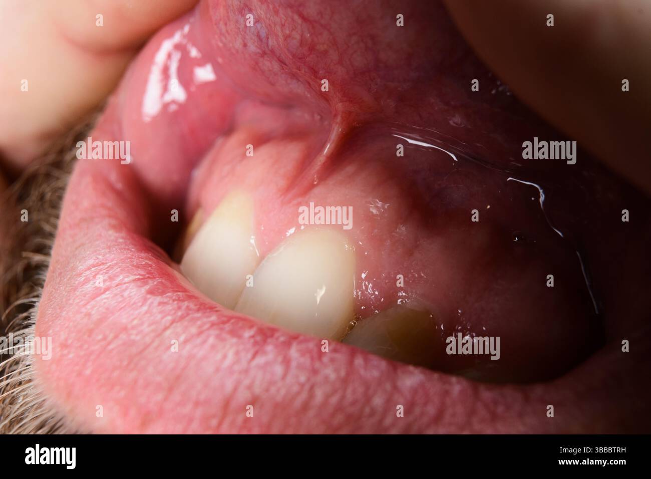 Vista dettagliata all'interno della bocca di una persona, evidenziando denti, gengive, lingua e saliva. L'immagine si concentra sulle consistenze e sull'umidità della cavità orale. Foto Stock