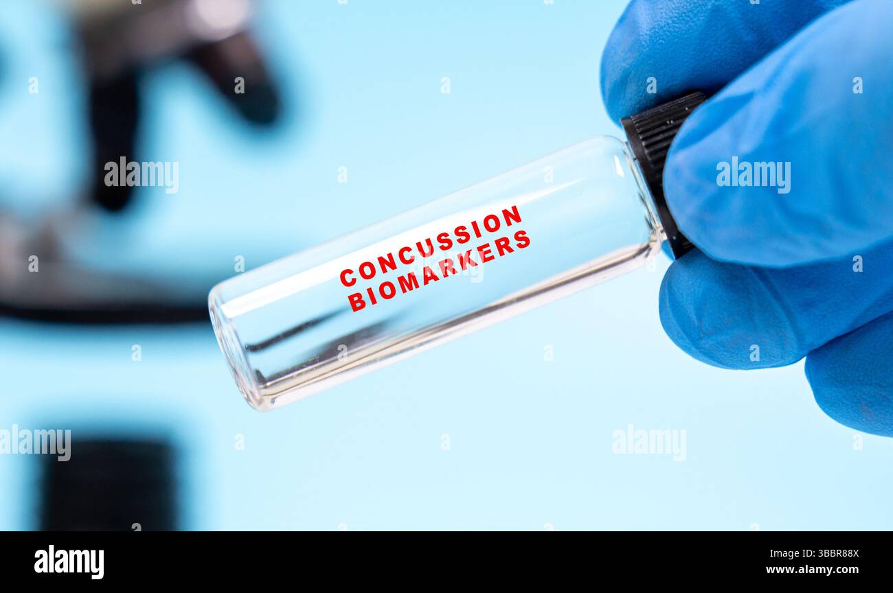 Test della saliva per biomarcatori di commozione cerebrale. Identifica i marcatori indicativi di commozione cerebrale o traumatica. Foto Stock