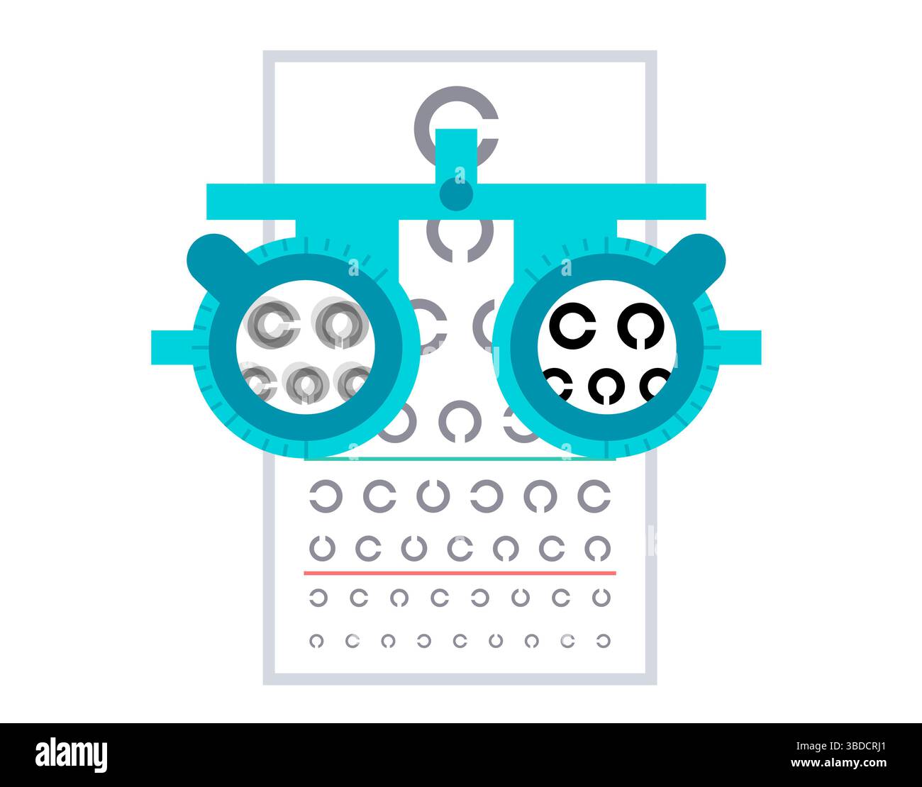 Illustrazione di ambliopia, chiamata anche occhio pigro. Si tratta di una riduzione della vista in un occhio causata da uno sviluppo visivo anomalo nelle prime fasi della vita. Gli occhi più deboli o pigri spesso vagano verso l'interno o verso l'esterno. I trattamenti includono lenti correttive, interventi chirurgici per allineare gli occhi disallineati e terapia della vista. Foto Stock