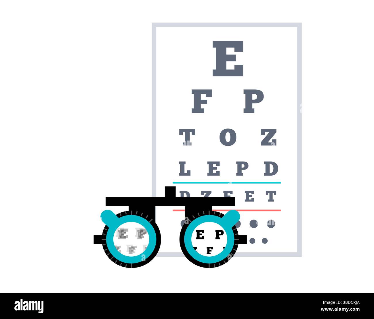 Illustrazione di ambliopia, chiamata anche occhio pigro. Si tratta di una riduzione della vista in un occhio causata da uno sviluppo visivo anomalo nelle prime fasi della vita. Gli occhi più deboli o pigri spesso vagano verso l'interno o verso l'esterno. I trattamenti includono lenti correttive, interventi chirurgici per allineare gli occhi disallineati e terapia della vista. Foto Stock