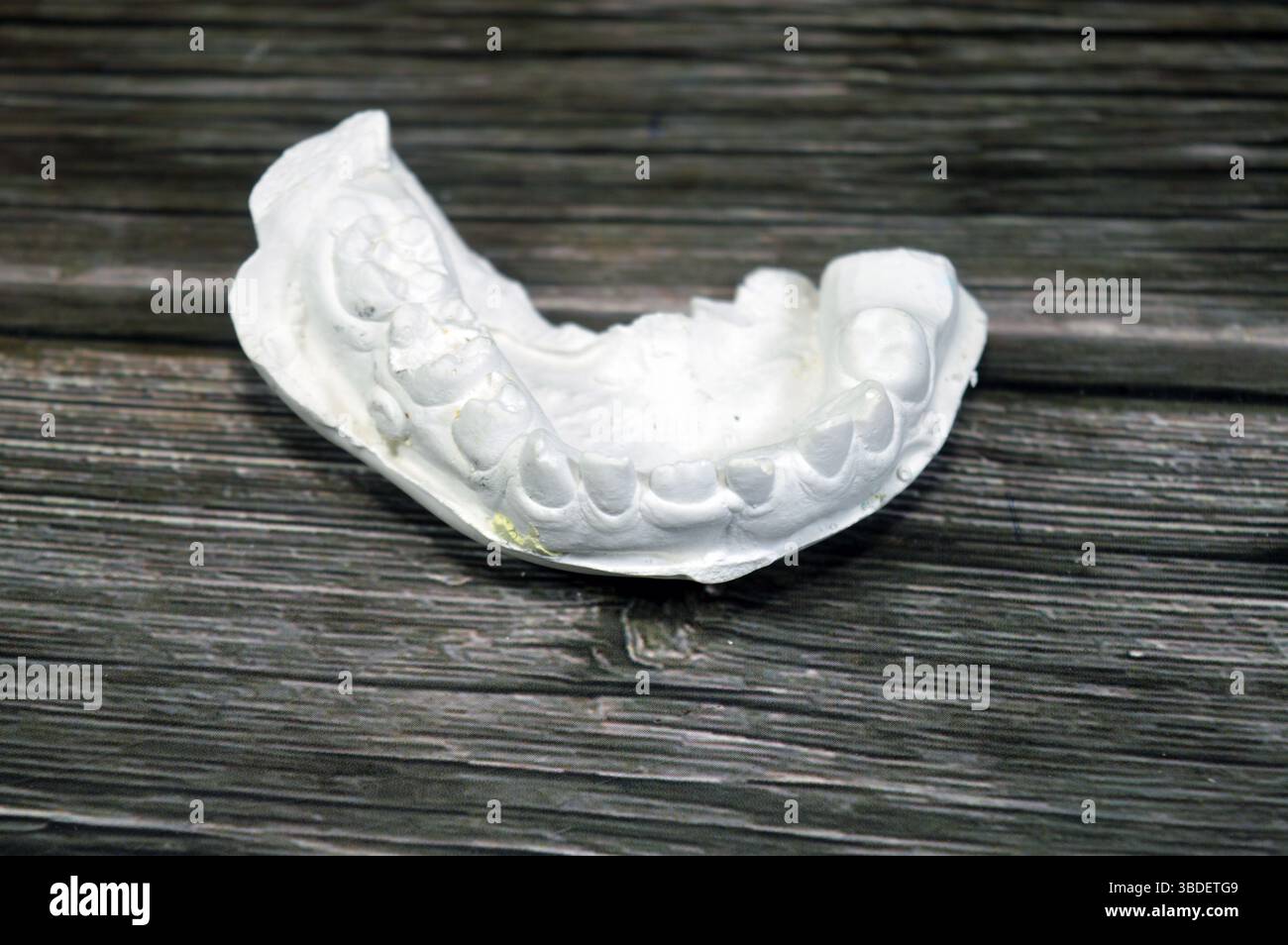 Il modello di fusione dentale ottenuto da impronta (un'impronta negativa dei denti e dei tessuti molli), modello di studio, è una riproduzione positiva della tettarella di un paziente Foto Stock