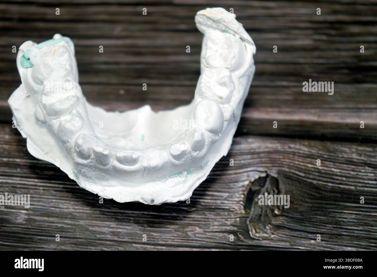 Il modello di fusione dentale ottenuto da impronta (un'impronta negativa dei denti e dei tessuti molli), modello di studio, è una riproduzione positiva della tettarella di un paziente Foto Stock