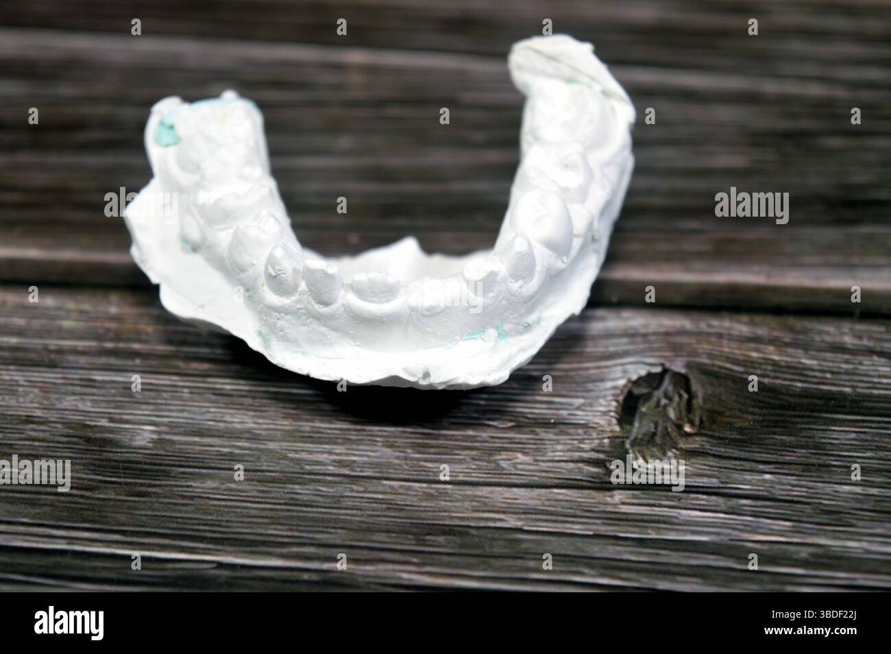 Il modello di fusione dentale ottenuto da impronta (un'impronta negativa dei denti e dei tessuti molli), modello di studio, è una riproduzione positiva della tettarella di un paziente Foto Stock
