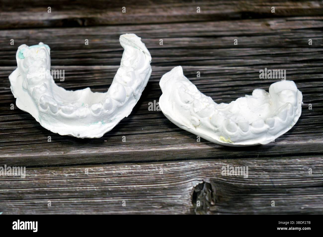 Il modello di fusione dentale ottenuto da impronta (un'impronta negativa dei denti e dei tessuti molli), modello di studio, è una riproduzione positiva della tettarella di un paziente Foto Stock