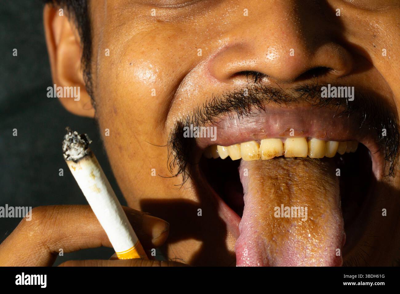 Once uomo asiatico ha la lingua gialla. Sintomi del tratto digerente, fegato e malattia della cistifellea. Effetti del consumo di sigarette sulla lingua Foto Stock