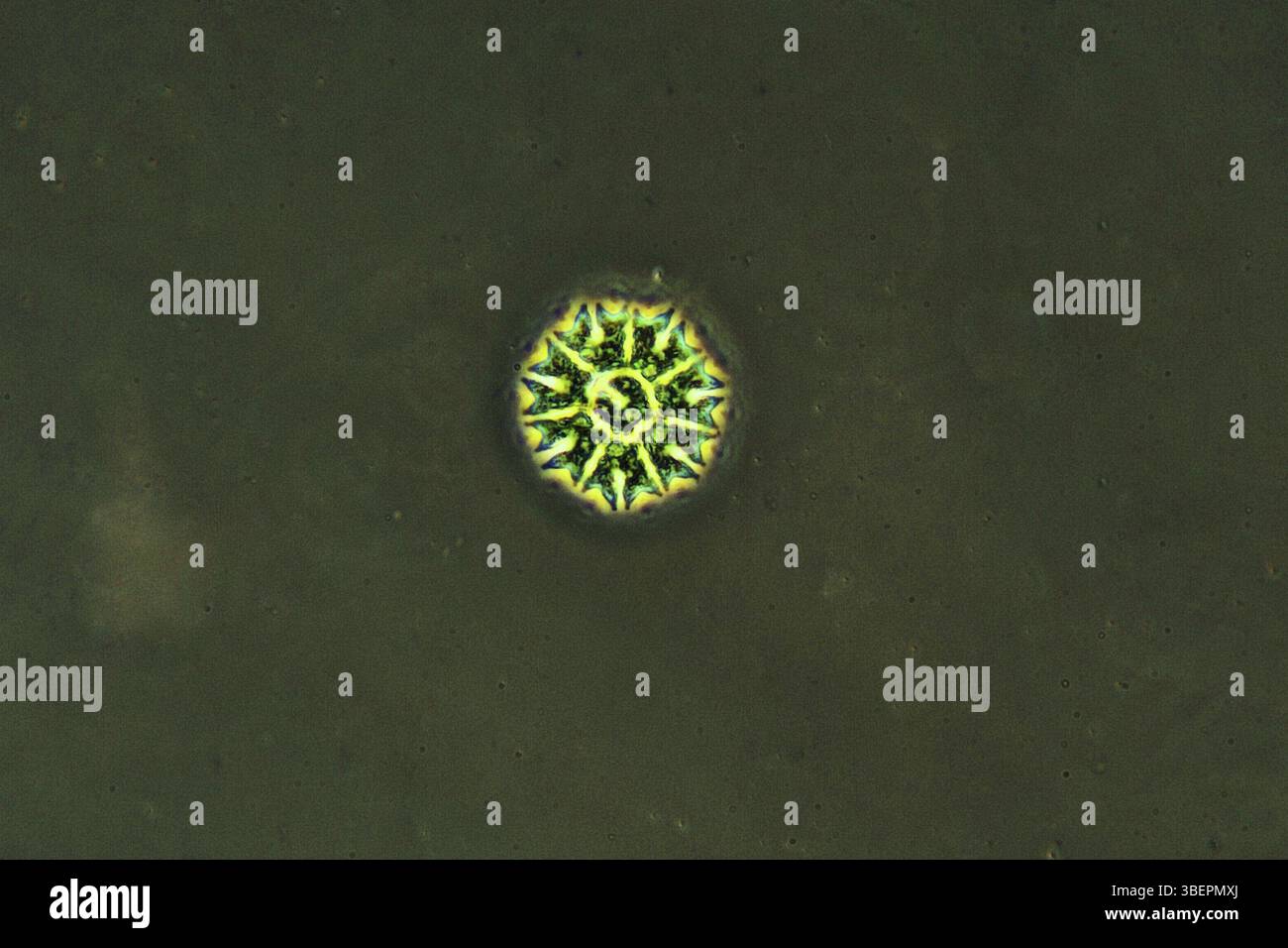 Ruota dentellata incisa per contrasto di fase 400x (Pediastrum Tetras) Foto Stock