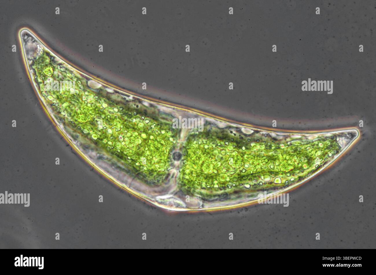 Contrasto di fase alga a luna grande 400x (Closterium ehrenbergii) Foto Stock