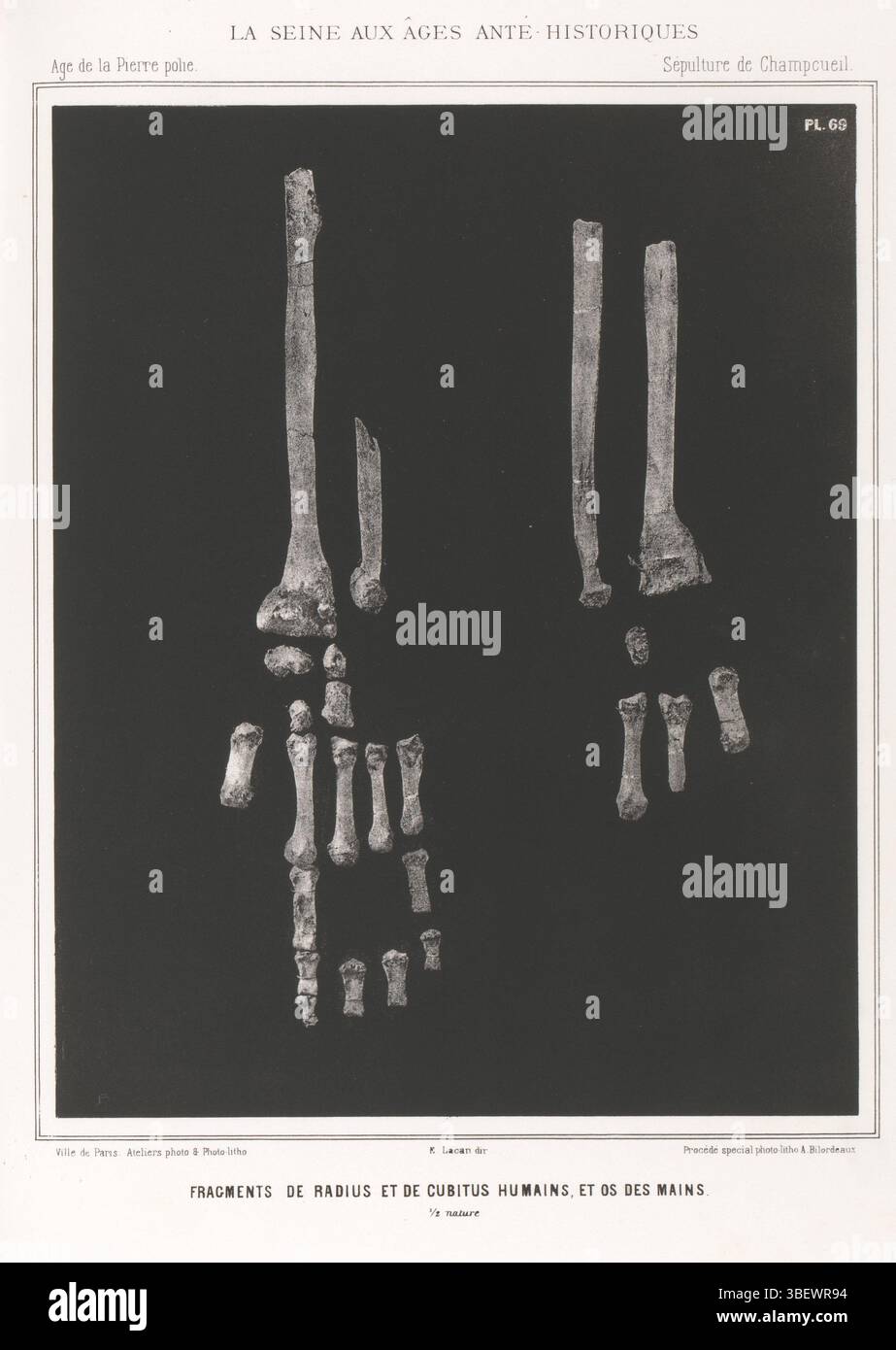 Lacan, E., Ville de Paris, Bilordeaux, Adolphe, frammenti dell'ulna, raggio e ossa del braccio e della mano umana, stampa fotomeccanica, pagina, foto, libri illustrati fotografici, Procédé spécial Photo-litho. A. Bilordeaux, 1/2 nature, PL.69, FRAGMENTS DE RADIUS ET DE CUBITUS HUMANINS, ET OS DES MAINS., altezza 238 mm, larghezza 190 mm, fotografo, 1864 - 1869, carta, fotolitografia, francese, 1807 - 1870, clichémaker, stampante, supervisione Foto Stock