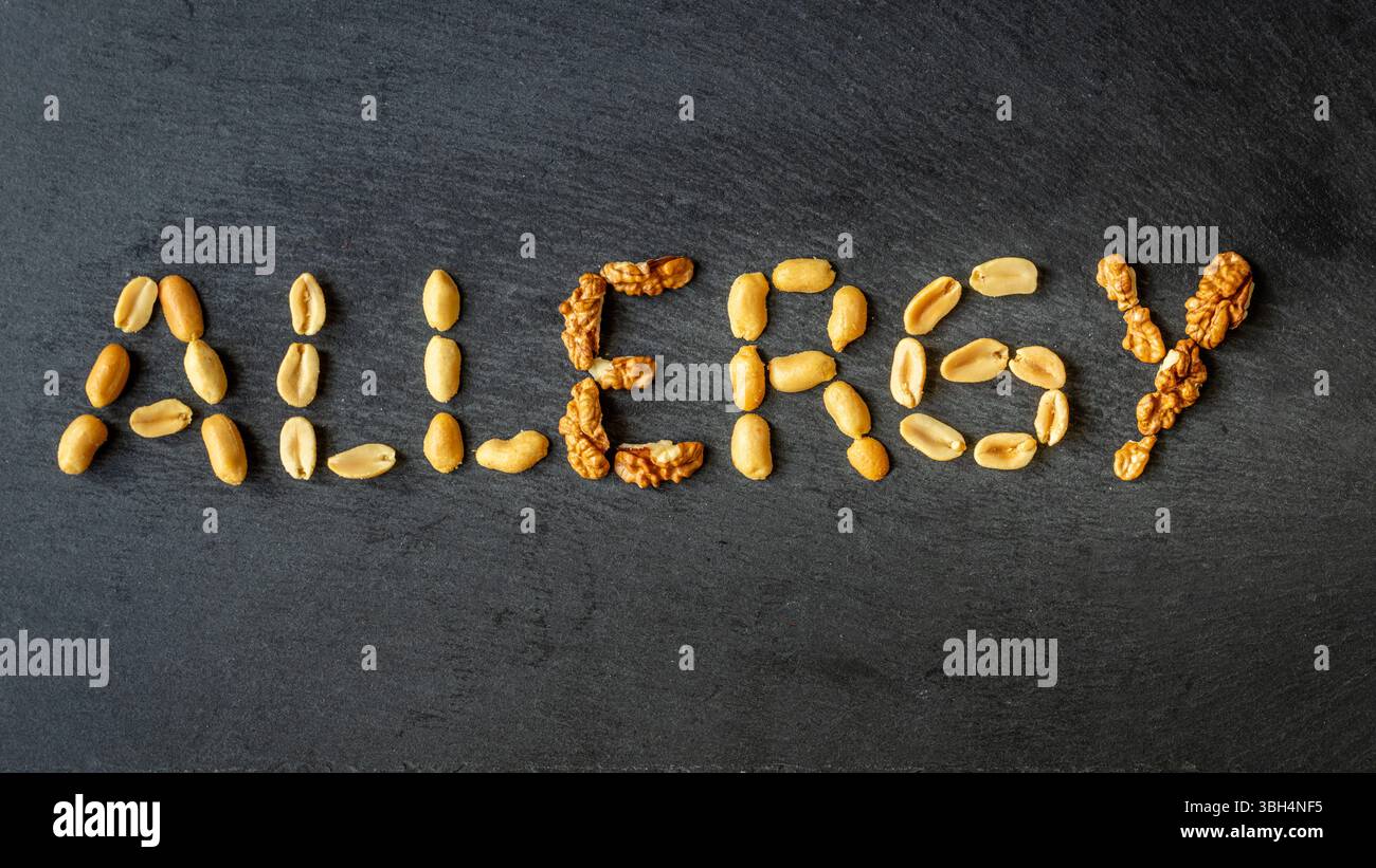Allergia alla noce. La parola ALLERGIA è composta da varie noci. Il concetto di salute. Reazione del sistema immunitario, shock anafilattico. Arachidi, sintomi di allergia Foto Stock