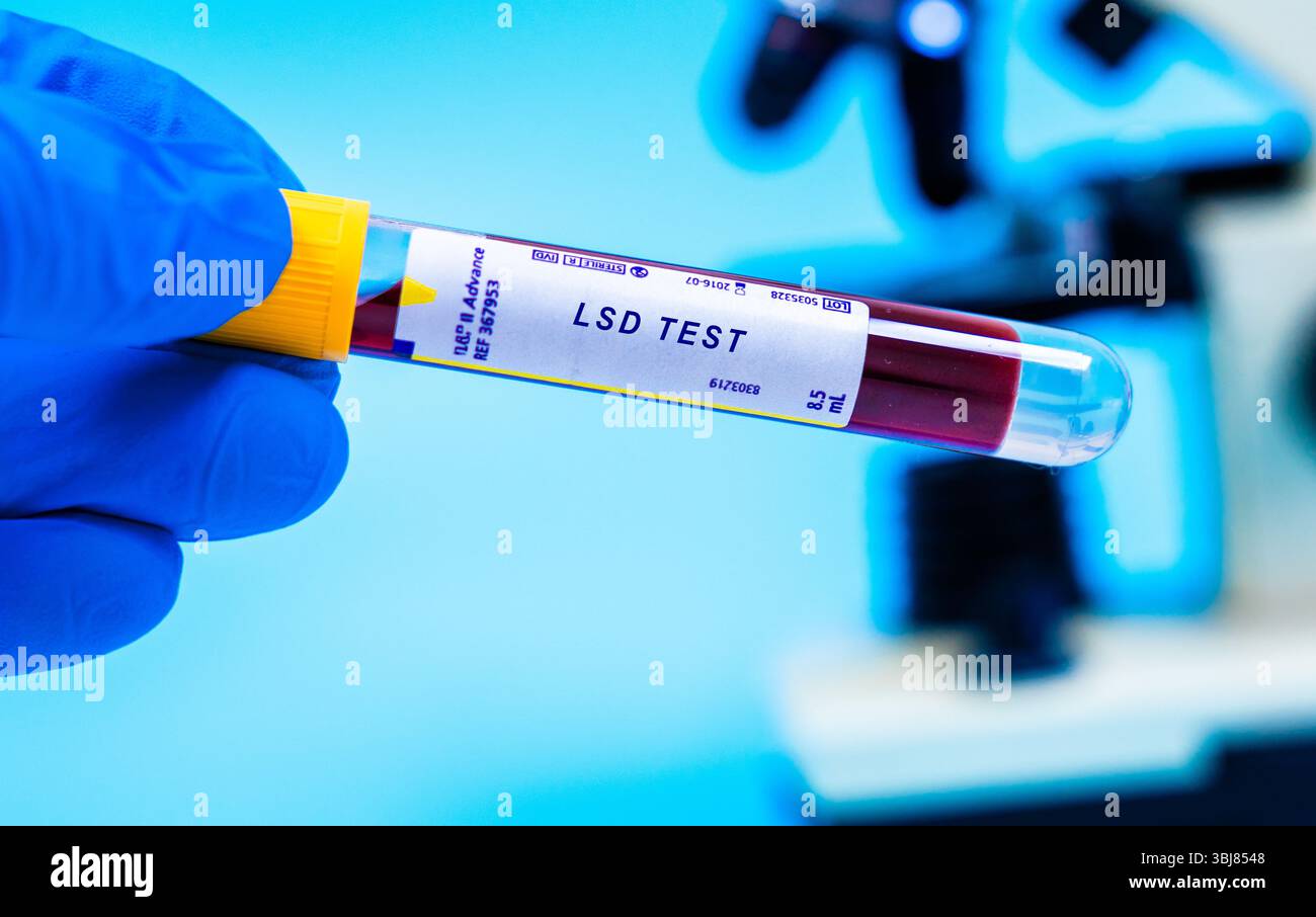 Test del sangue dell'LSD. Identifica l'LSD, un potente farmaco allucinogeno noto per alterare la percezione e l'umore. Foto Stock
