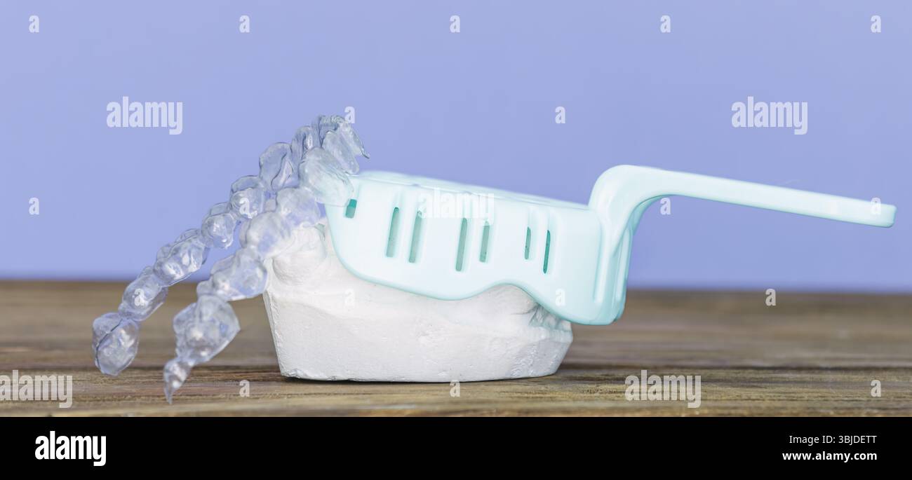 Allineatore ortodontico trasparente posizionato su uno stampo dentale in gesso, con un vassoio di impronta sullo sfondo su una superficie in legno. Foto Stock