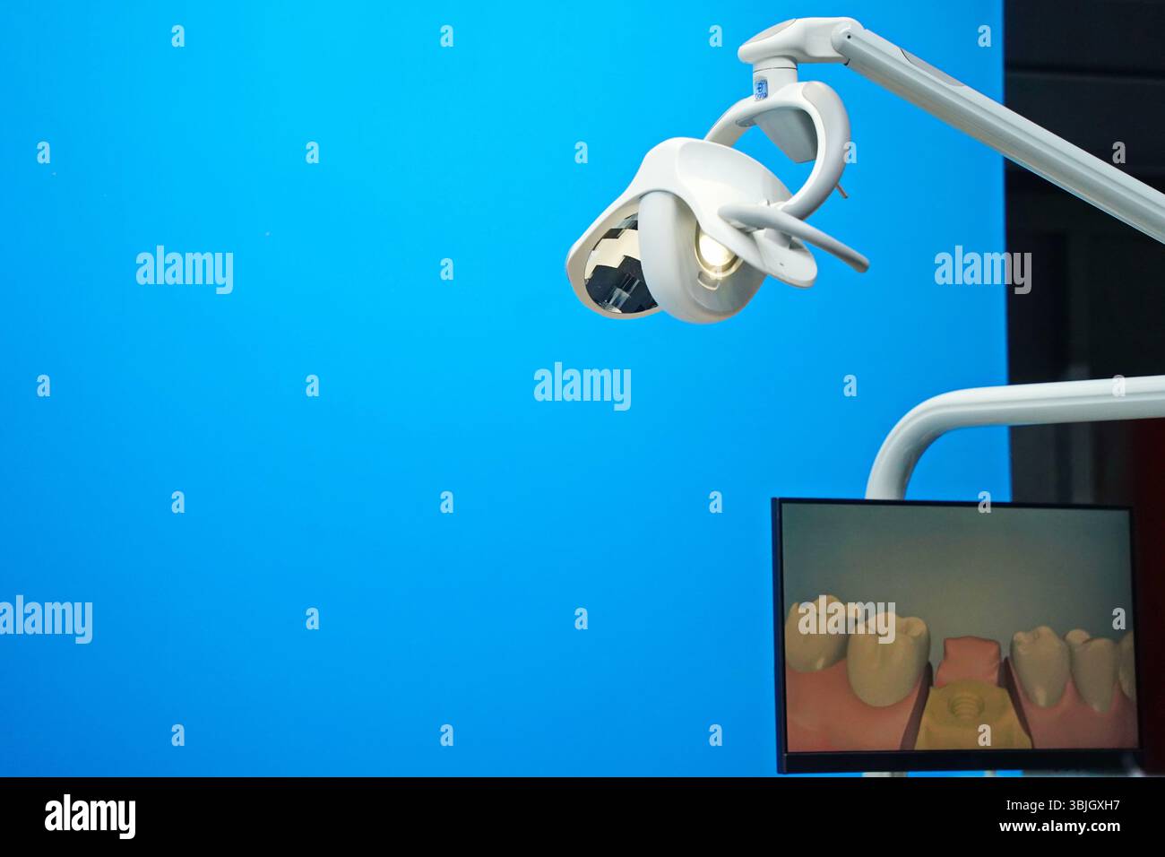 Apparecchiature per procedure e operazioni dentistiche. Foto Stock
