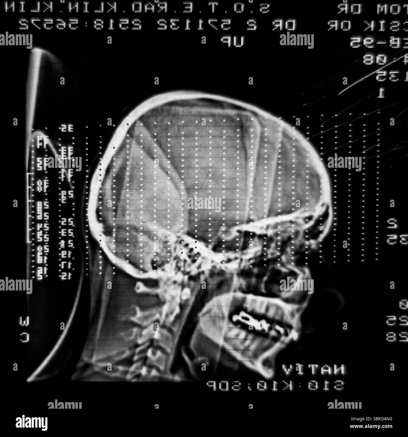 Foto ravvicinata della scansione RM luminosa e radiosa Foto Stock