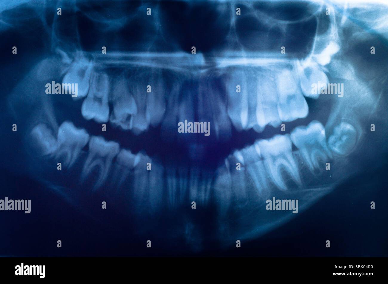 Primo piano del cranio umano Foto Stock