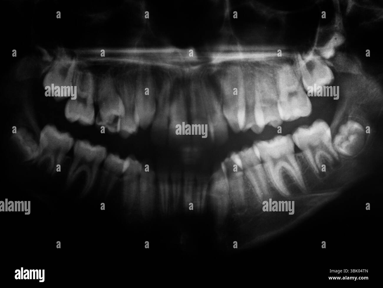 Primo piano del cranio umano Foto Stock