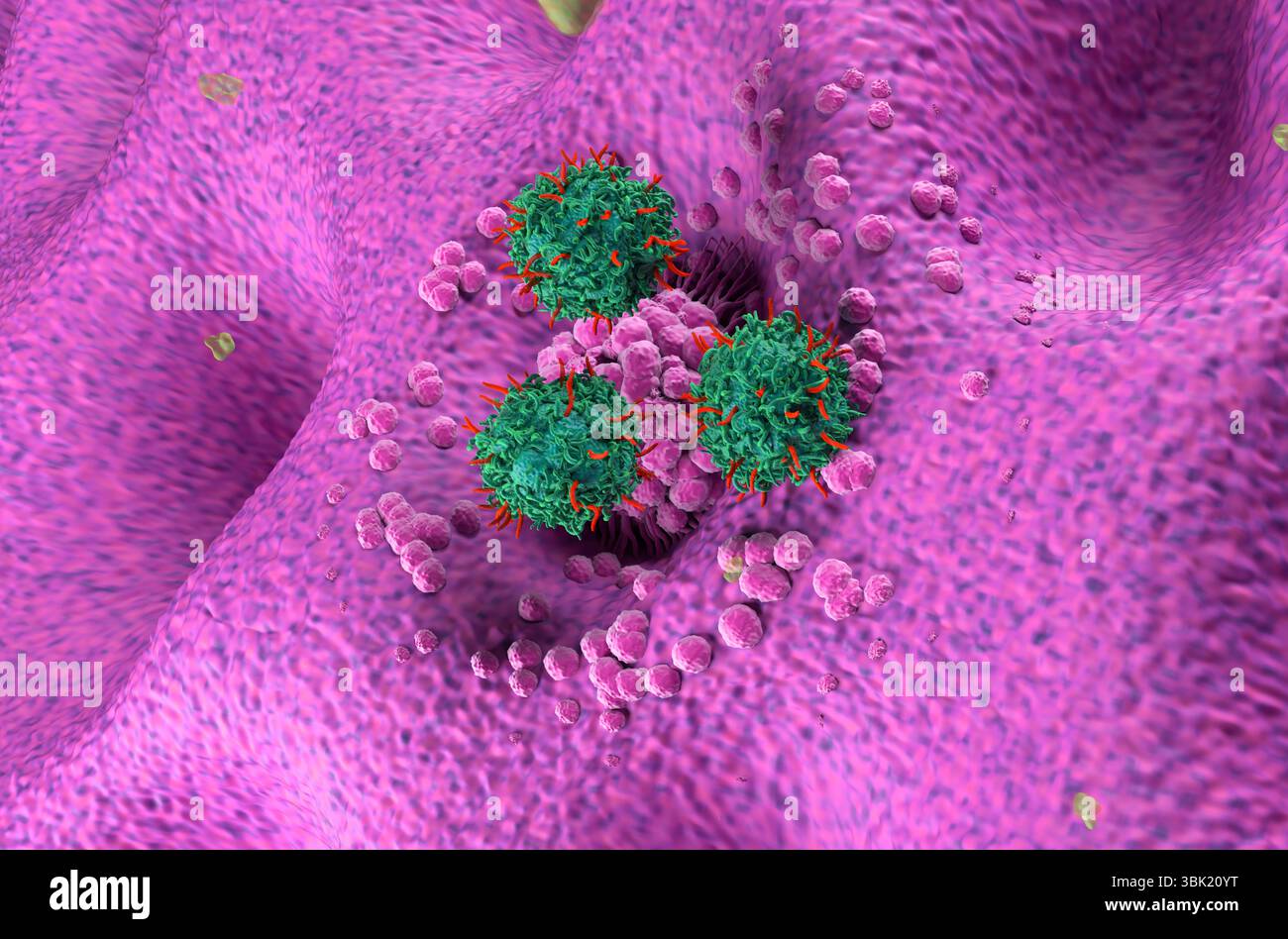Terapia con cellule T di CAR nel cancro dello stomaco (gastrico) - Vista isometrica illustrazione 3d. Foto Stock