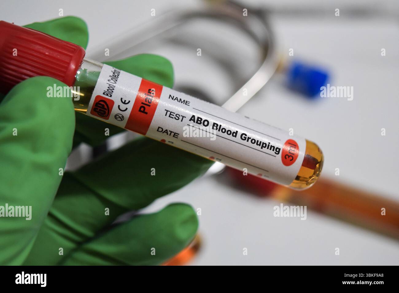 ABO Blood Grouping - test con campione di sangue. Vista dall'alto isolata sulla scrivania dell'ufficio. Concetto sanitario o medico Foto Stock