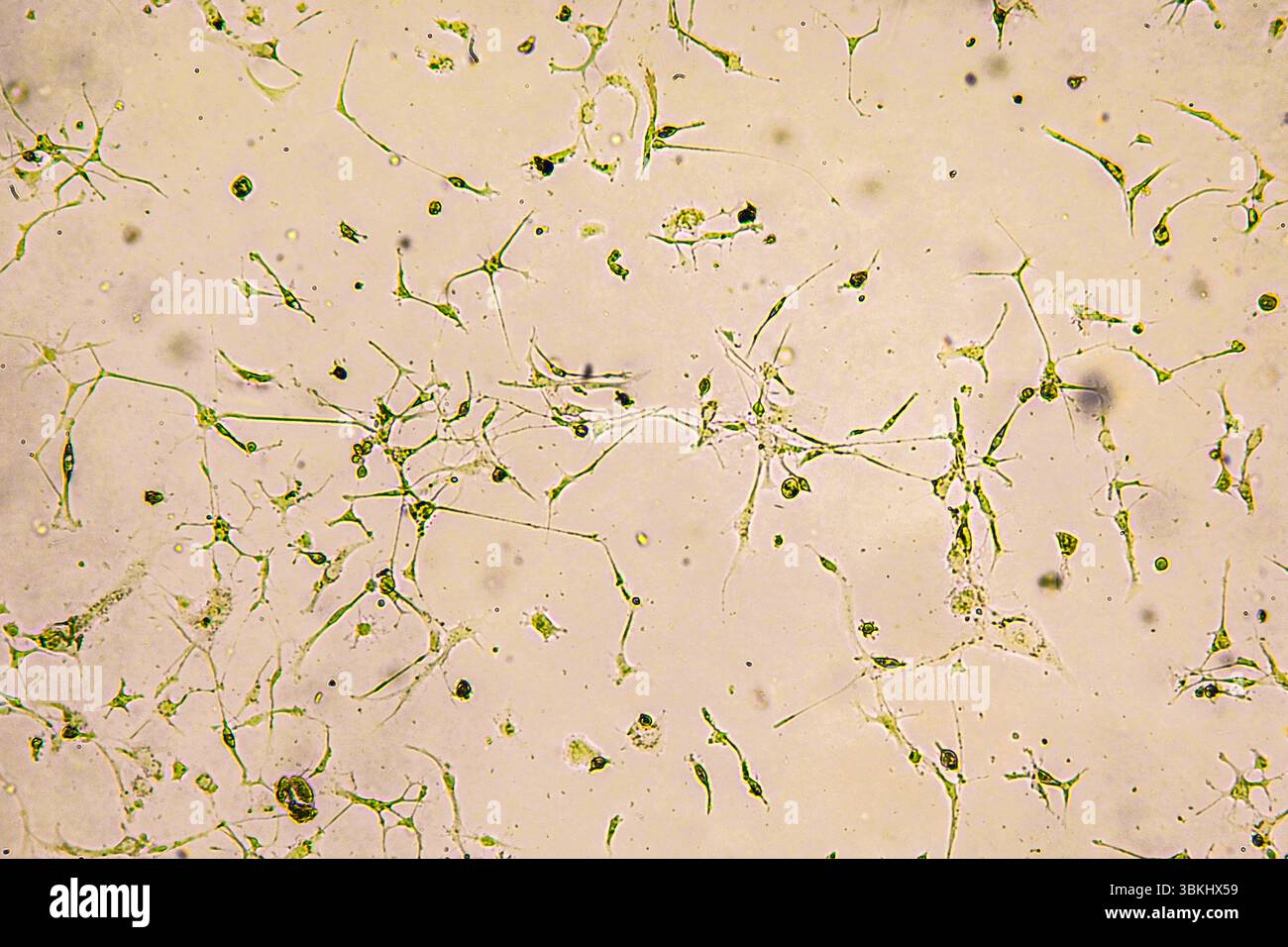Coltura cellulare glioblastoma. Cellule del glioma umano in fase di ingrandimento. Foto Stock