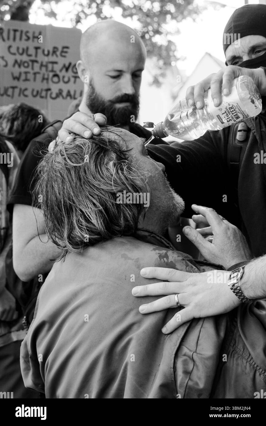 Un uomo sconosciuto dal lato antifascista della protesta UKIP riceve il primo soccorso dopo essere stato presumibilmente spruzzato al pepe dalla polizia Foto Stock