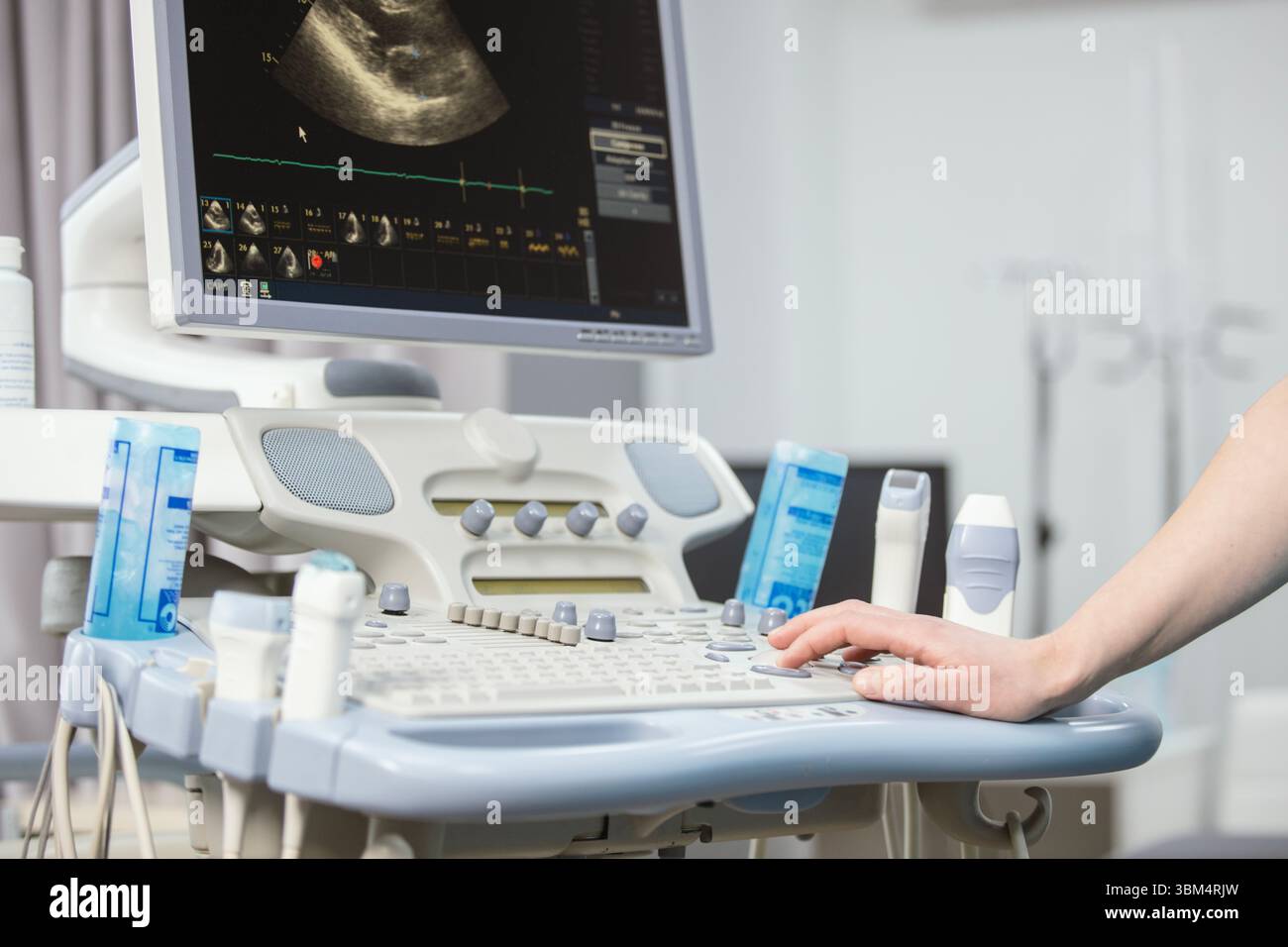 Moderne attrezzature mediche nella clinica. Una macchina a ultrasuoni. Elastografia e sonografia. Medico con una macchina a ultrasuoni moderna, scanner. Foto Stock