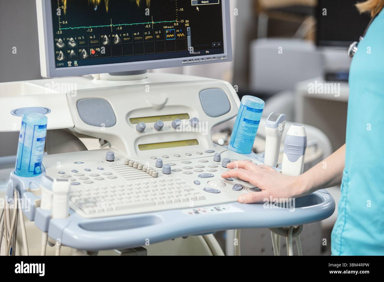 Moderne attrezzature mediche nella clinica. Una macchina a ultrasuoni. Elastografia e sonografia. Medico con una macchina a ultrasuoni moderna, scanner. Foto Stock