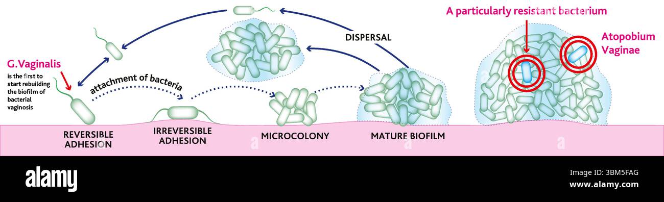 Formazione di biofilm. Processo di ricostruzione del biofilm della vaginosi batterica con la meccanica del suo sviluppo e della sua crescita. Illustrazione Vettoriale