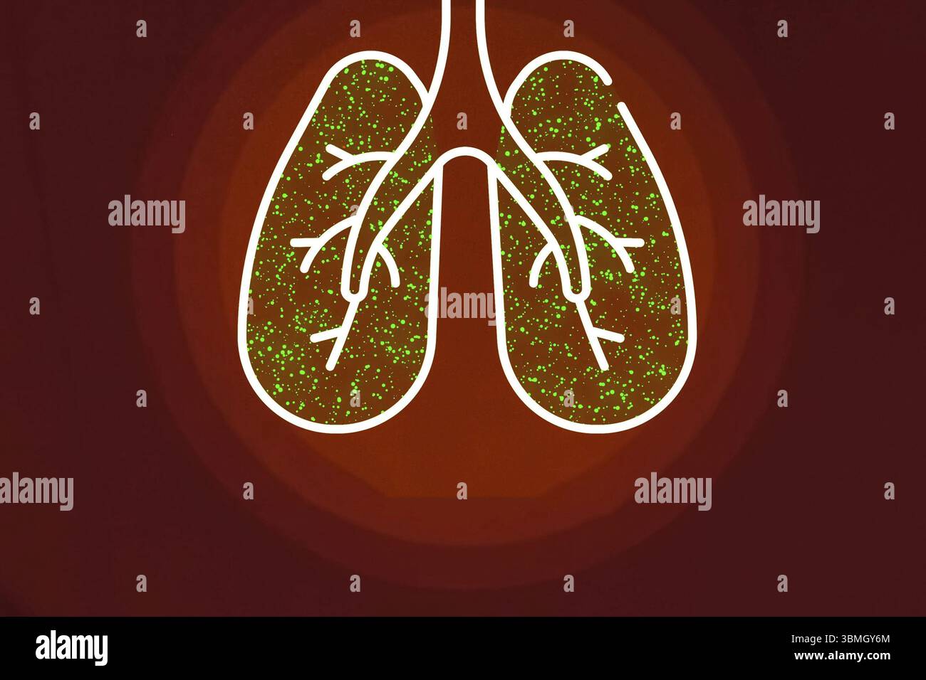 Polmoni infettati da coronavirus. Illustrazione dei polmoni di una persona Foto Stock