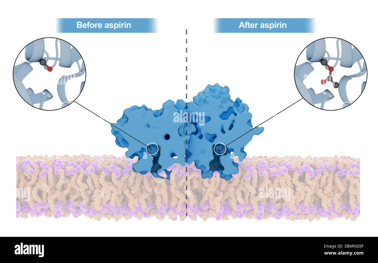 Illustrazione del meccanismo d'azione dell'aspirina all'interno dell'enzima cicloossigenasi (COX). L'aspirina acetilata è un residuo serino chiave di COX, portando a un cambiamento strutturale irreversibile nel sito attivo di COX che impedisce che agisca sull'acido arachidonico per produrre risposte infiammatorie. Foto Stock