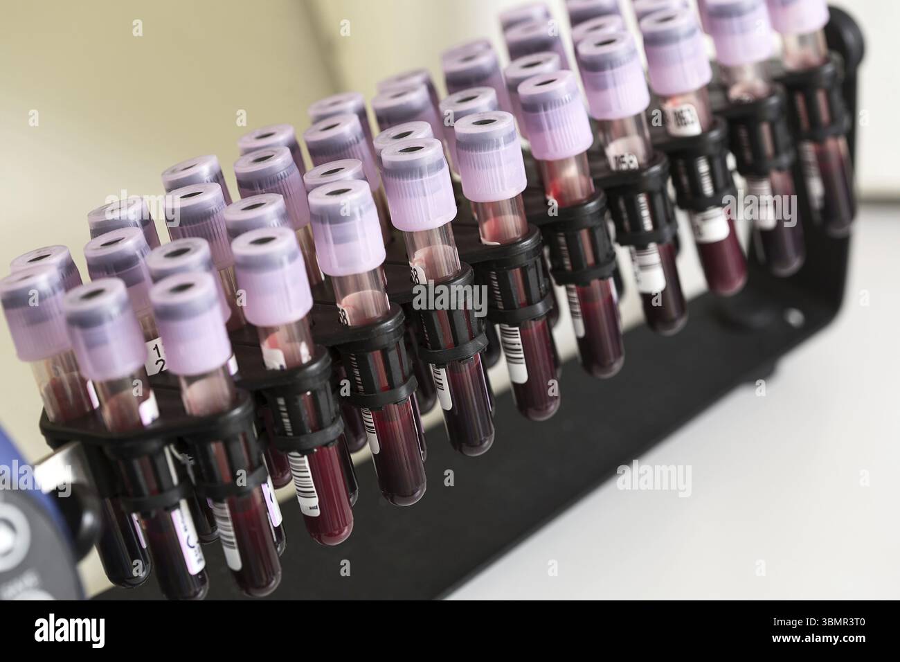 Provetta campione di sangue in una visita medica. Ricerca medica Foto Stock