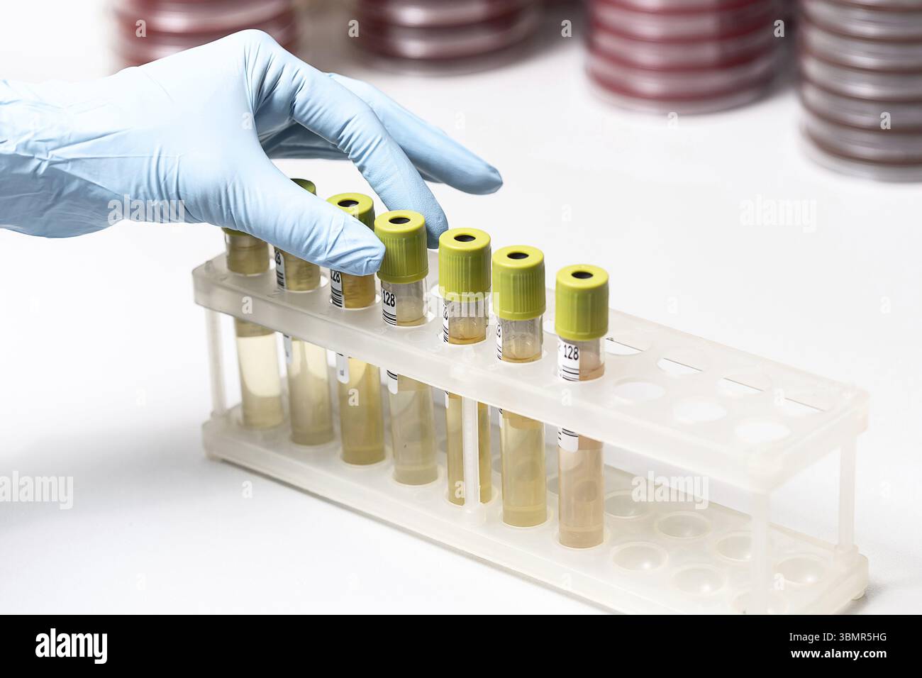 Provette con liquido giallo in laboratorio. Ricerca medica Foto Stock