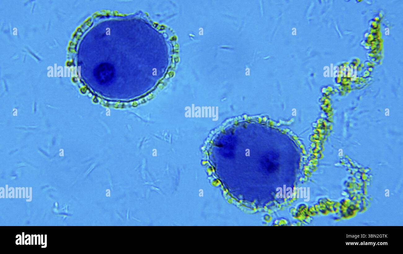 Lillium anther sotto microscopio ottico Foto Stock