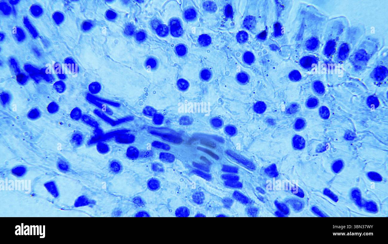 Lillium 0Vare sotto microscopio ottico Foto Stock