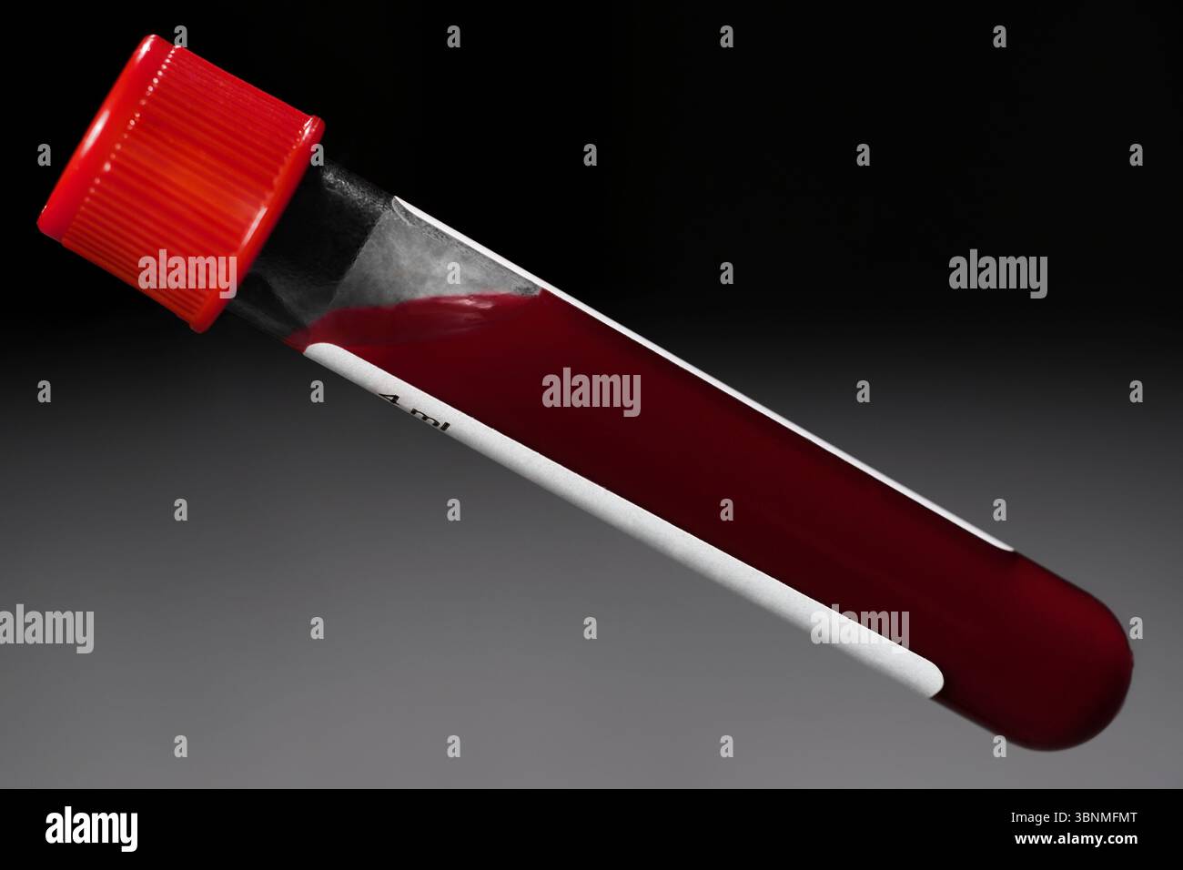 Campione di sangue in provetta di vetro per l'esame del sangue di laboratorio Foto Stock