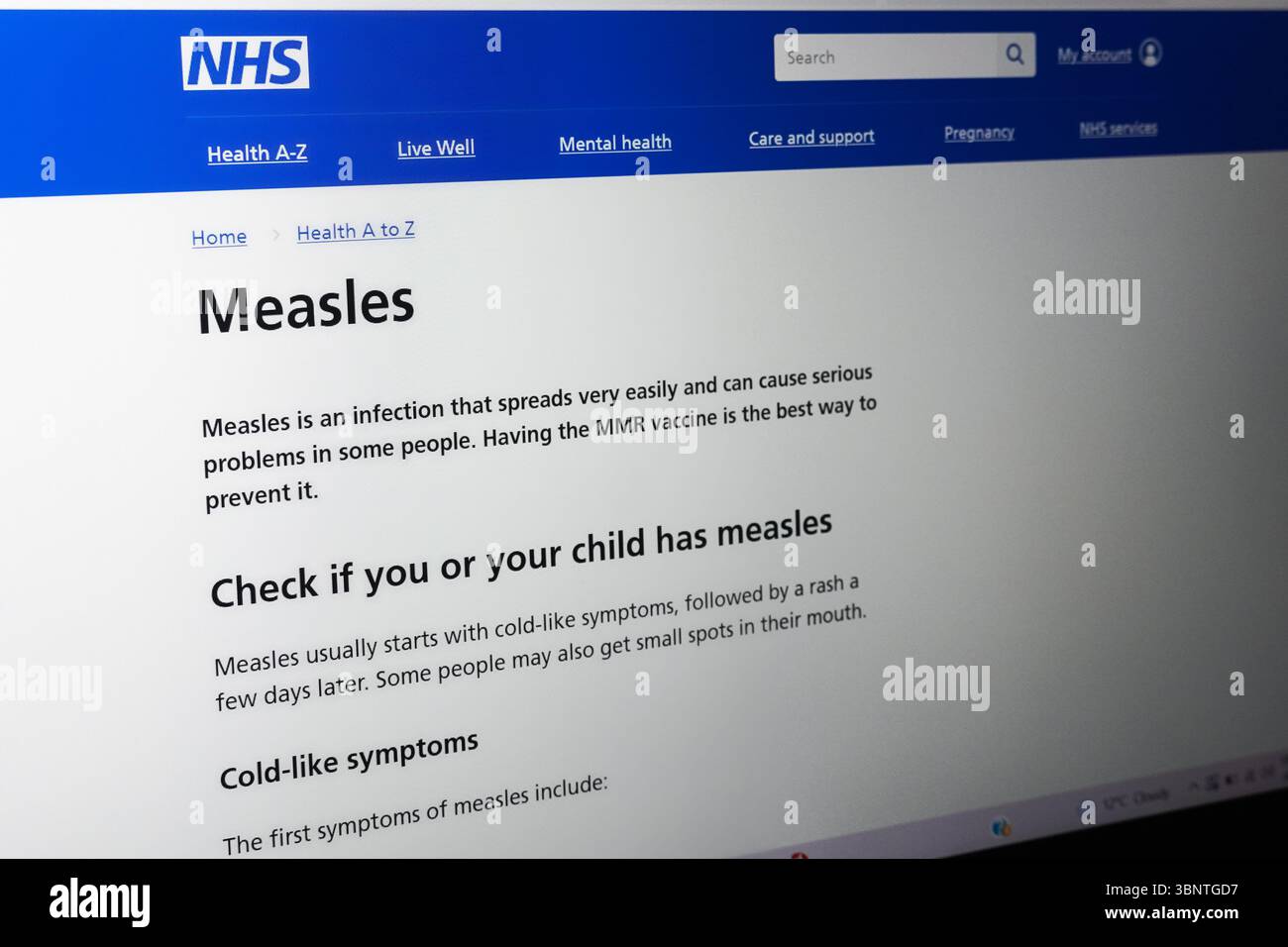 Il sito web della NHS con informazioni sul morbillo Foto Stock
