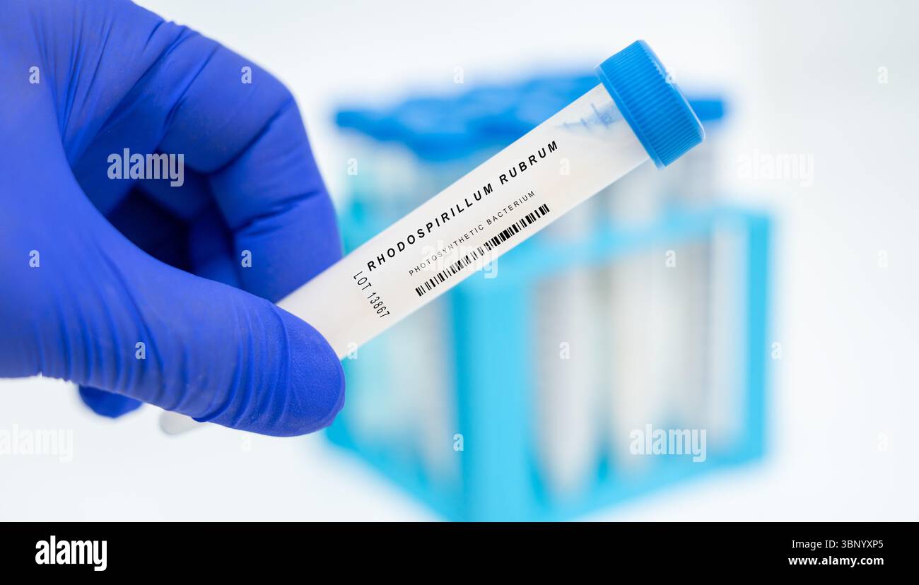 Rhodospirillum rubrum. Batterio fotosintetico. Utilizzato negli studi di fissazione dell'azoto e produzione di idrogeno. Foto Stock